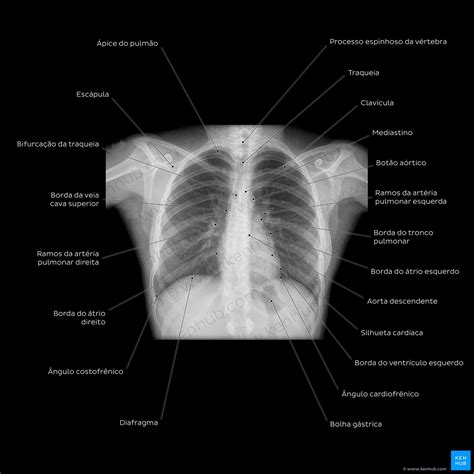 Imaginologia E Anatomia Radiol Gica Raios X Tc Rm Kenhub