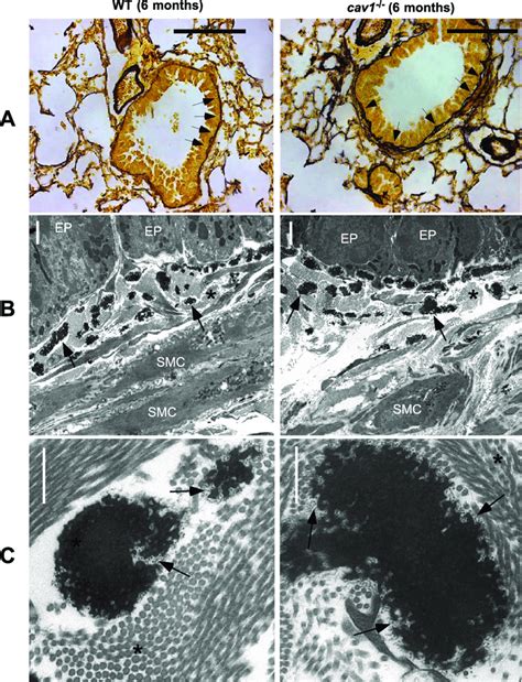 Distribution And Structure Of Elastic Fibers In Pulmonary Airways Of