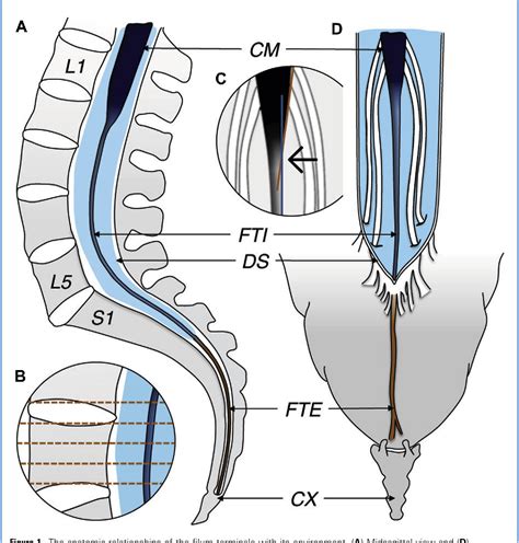 Coccygeal ligament | Semantic Scholar