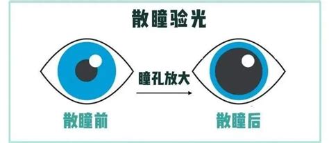 “真假”性近视傻傻分不清楚？出现以下症状家长务必重视！ 眼科知识 焦作复明眼科医院