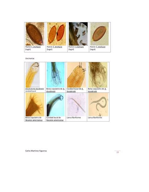 Atlas De Parasitologia Clinica Pdf