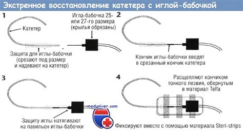 Осложнения катетеризации центральных вен у новорожденного
