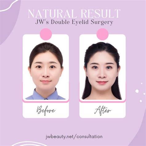 Korean Plastyកែសម្ផស្ស នៅប្រទេសកូរ៉េ