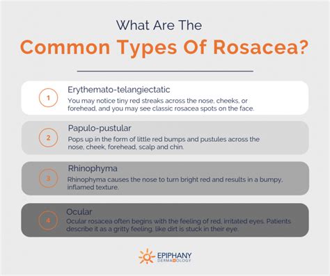 The Complete Guide To Rosacea Treatment Epiphany Dermatology