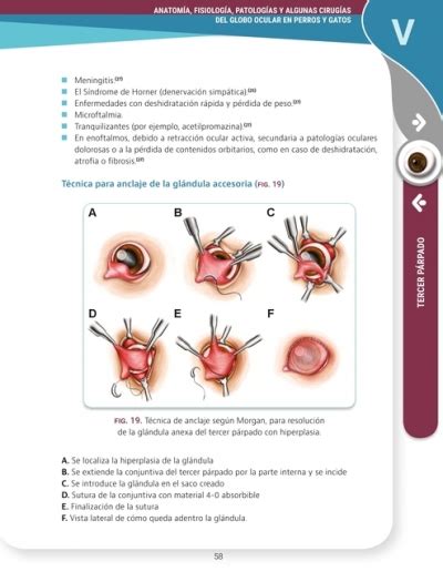 Anatomía fisiológia patologías y algunas cirugías del globo ocular en