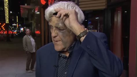 Medical Expert Debunks For Us Viral Rumors About Jay Leno S Black Eye