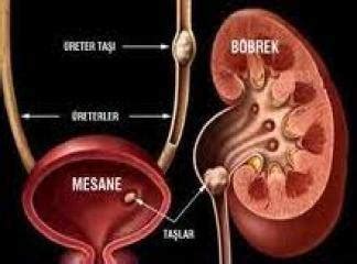 Şifalı Bitkilerim Böbrek Taşı Nasıl Oluşur