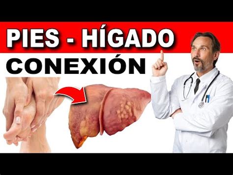 Qu Dicen Tus Pies Sobre Tus Problemas De H Gado Youtube