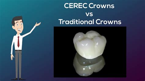 Cerec Crowns Vs Traditional Crowns 02 8090 1105 Dental Crowns