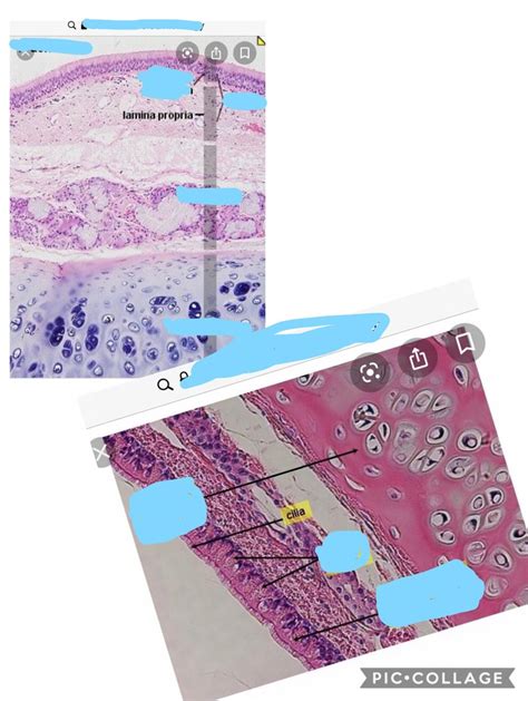 Histology A P Ii Lab Diagram Quizlet