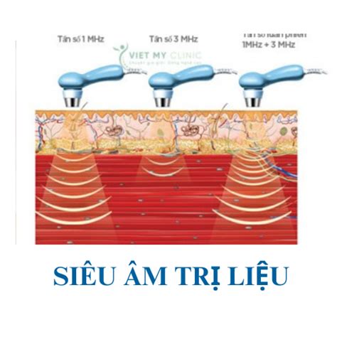 Bệnh cơ xương khớp