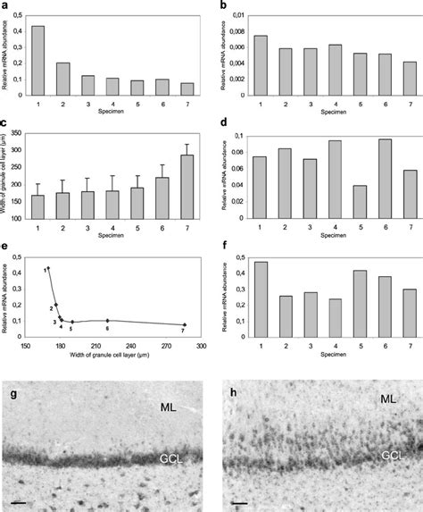 Reelin Mrna Expression In The Dentate Gyrus Of Control And Epileptic