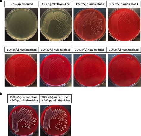 Blood Agar Staphylococcus Aureus