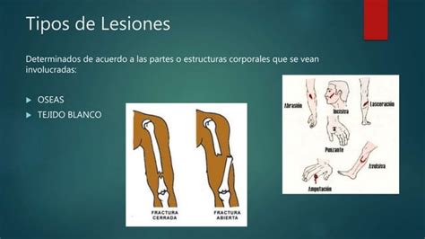 Lesiones Comunes En La Danza Ppt