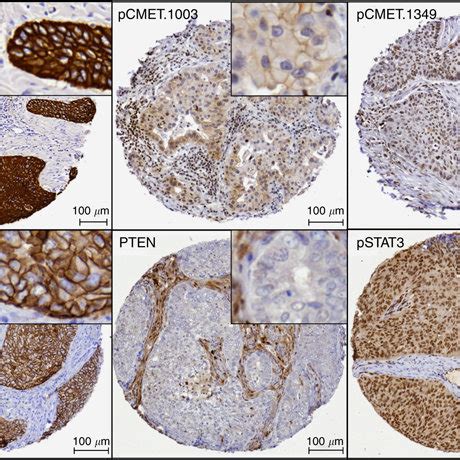 Representative Immunohistochemical Staining Pattern For Several Of The