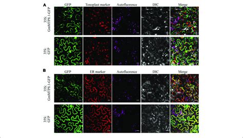 Subcellular Localization Of Gmmtp81 In Tobacco Leaf Lower Epidermal