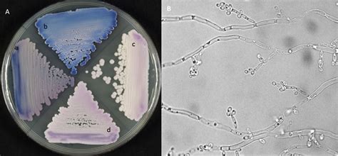 A CHROMagar Candida Showing Colony Characteristics Of The Following