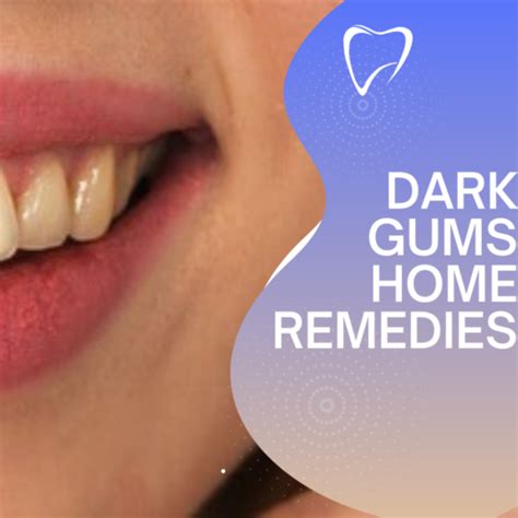 Dark Gums Home Remedies: How To Cure It Naturally