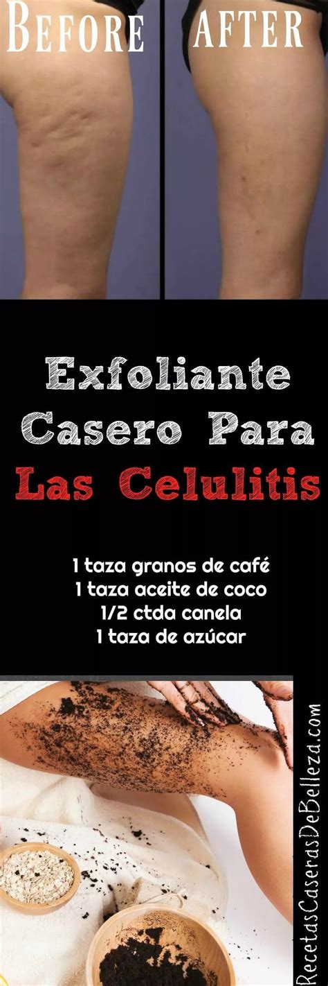 Exfoliante Casero Para Las Celulitis Exfoliante Casero Tratamientos