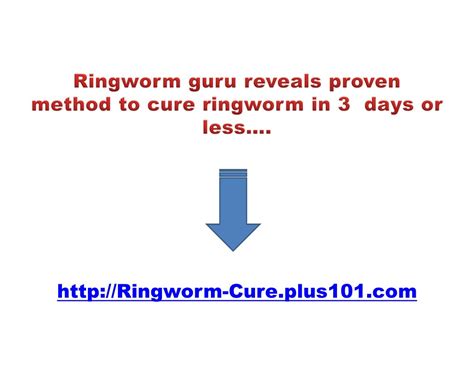 Ppt Getting Rid Of Ringworm How Long Does It Take To Cure Ringworm Best Way To Get Rid Of