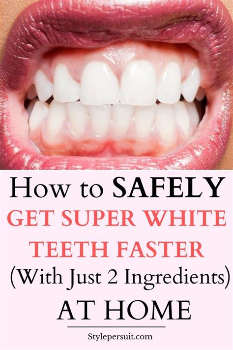 How To Whiten Teeth At Home In 2024 Home Whitening Teeth Teeth