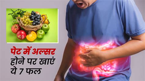 पेट में अल्सर छाले होने पर खाएं ये 7 फल मिलेगा आराम Fruits To Eat During Ulcerative Colitis