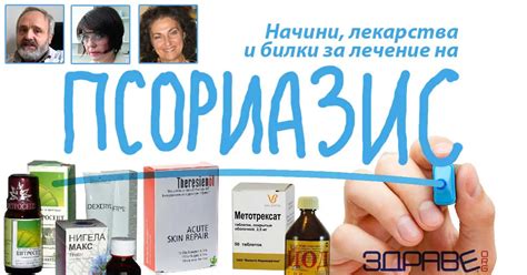 Крем за лечение на псориазис, мехлем: официални и домашни рецепти