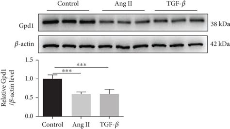 Mir P Affects Cardiac Fibrosis By Targeting Gpd A Three