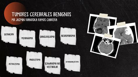 TUMORES CEREBRALES BENIGNOS by Jazmin Ramos on Prezi