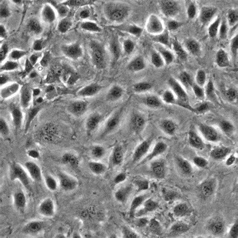 Human Dermal Lymphatic Endothelial Cells Innoprot Dermal Primary Cells