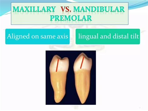 Tooth morphology...the architecture of part 3.....premolar and molar | PPT