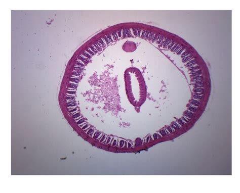 Earthworm Composite – Cross Section – Prepared Microscope Slide ...