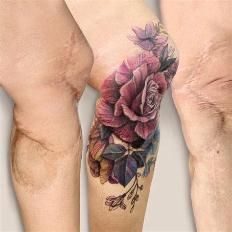 50 Times People Asked To Cover Up Their Scars And This Tattoo Artist Nailed It New Pics Artofit