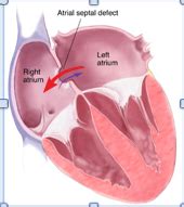 Patho Cardio Lecture Flashcards Quizlet