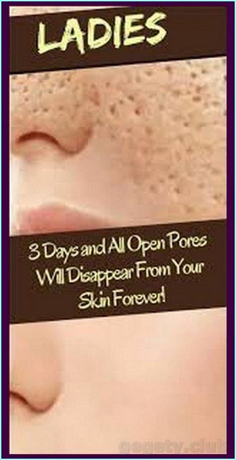 Days And All Open Pores Will Disappear From Your Skin Permanently