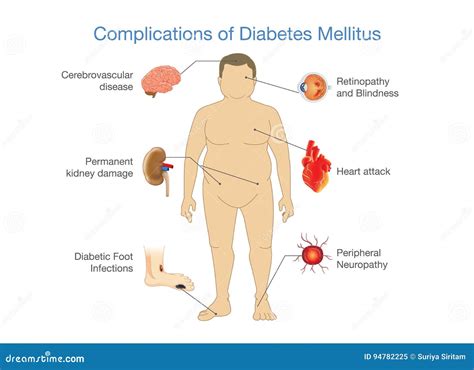 Complicaciones De La Diabetes Mellitus