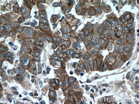 Beta Catenin Antibody 51067 2 Ap Proteintech 武汉三鹰生物技术有限公司