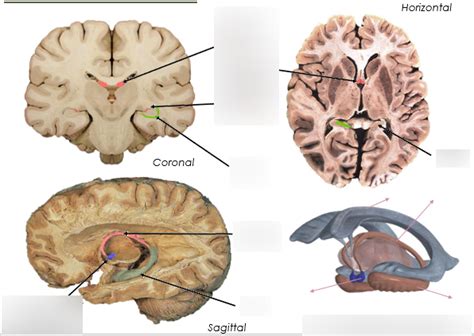 Lecture 20 Hippocampus Planes Of Dissection Diagram Diagram Quizlet