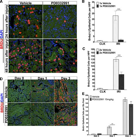 PD 0332991 PD Attenuates Tubular Epithelial Cell Division After