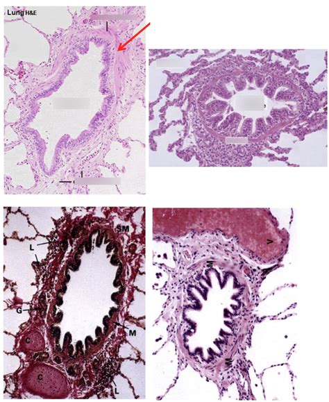 Bronchiolar Histology Diagram | Quizlet