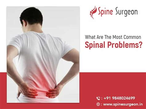 What are the most common spinal disorders? | Spine Surgeon