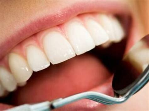 Caries y periodontitis enfermedades bucales más comunes