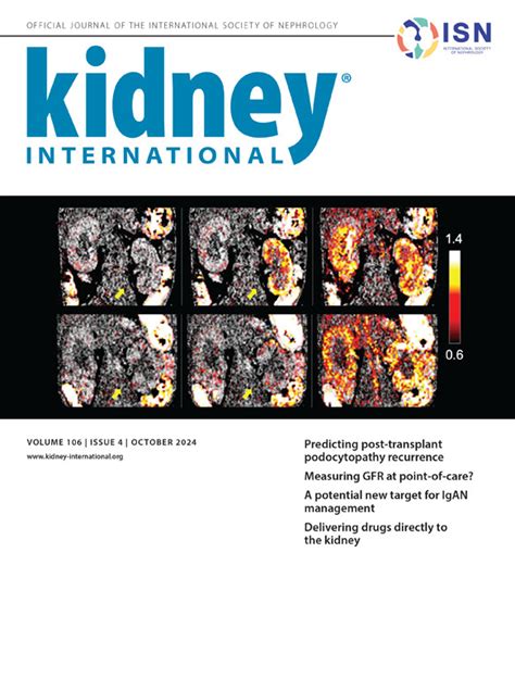 KDIGO 2024 Clinical Practice Guideline For The Management Of LUPUS