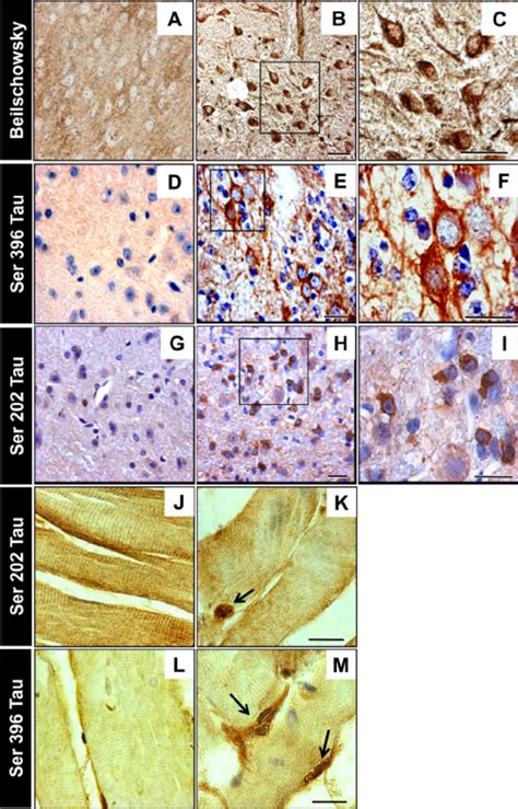 Histochemical And Immunohistochemical Assessment Of The Brain And