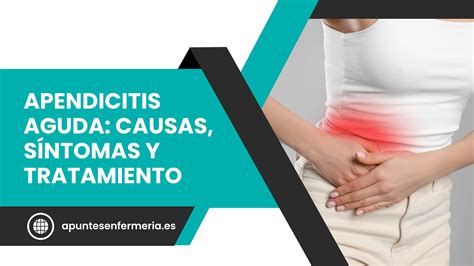 Apendicitis Aguda Causas Síntomas Y Tratamiento Apuntes Enfermería