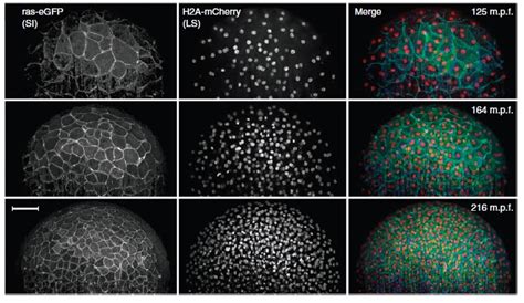 Biophotonics Review: Combining digital scanned laser light-sheet fluorescence microscopy with ...