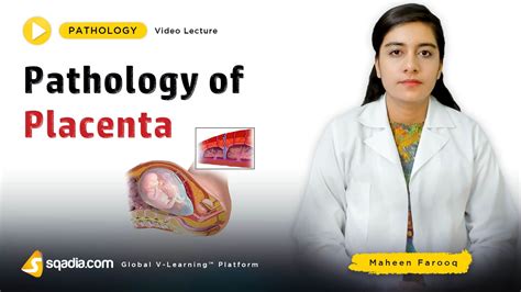 Pathology of Placenta | Online Medical V-Learning