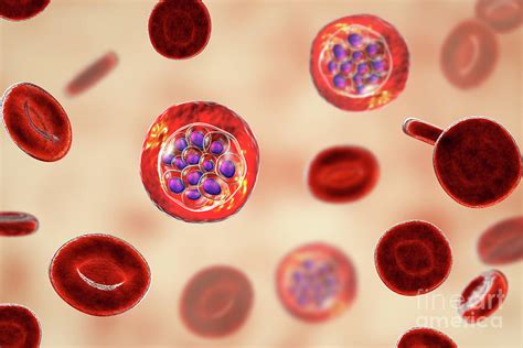 Plasmodium Vivax Inside Red Blood Cells Photograph By Kateryna Kon