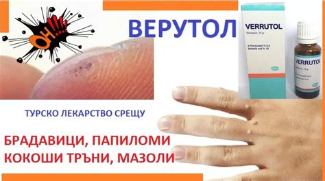 Верутол. Мнения. Как се използва лекарството. Листовка. За гъбички по ...