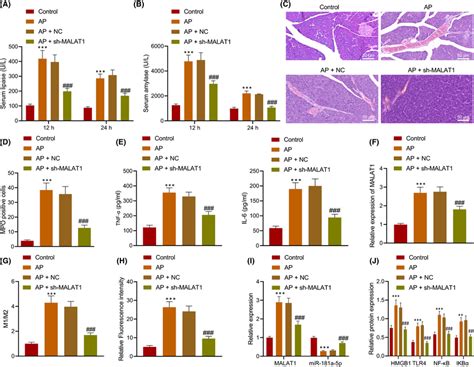 Silencing Of MALAT1 Reduced Pancreatic Tissue Injury In AP Mice AP